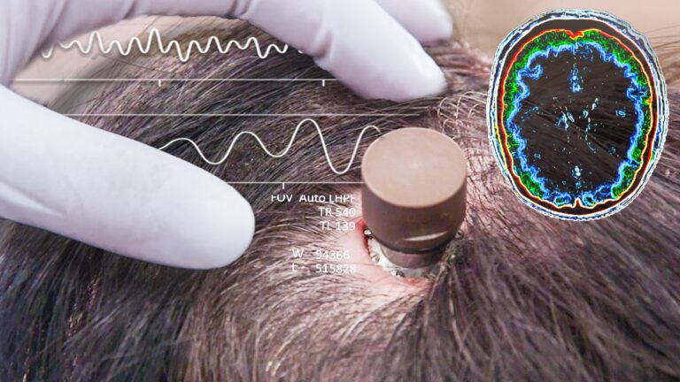 Elon Musk’s Neuralink Corp. to Start Putting Computer Chips in Human Brains